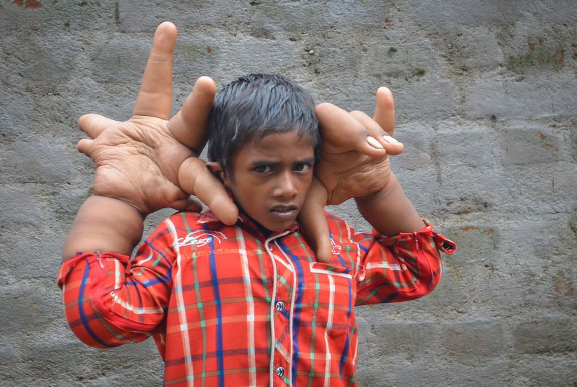 boy6