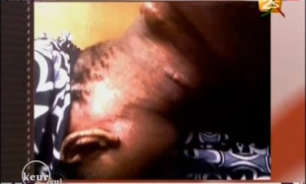 Vidéo: Elle verse de l’eau en ébullition sur sa voisine en la surprenant. Regardez