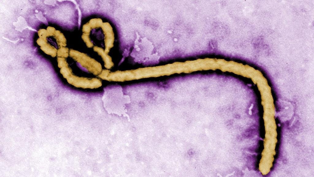 Guinée : Des coupeurs de route s’emparent d’un échantillon du virus Ebola