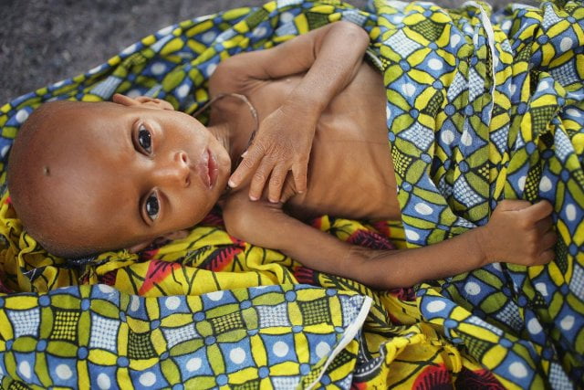 Santé « mère-enfant » à Matam : 0 gynécologue, 532 mort-nés et 54 femmes mortes en couches en 2014