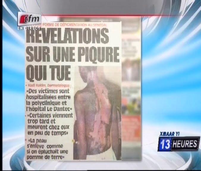 Vidéo: « Xessal »: Révélations sur une piqure qui tue
