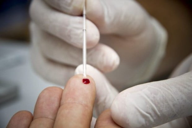 Scandale au niveau du programme national de lutte contre la tuberculose : du matériel périmé utilisé pour des tests vih chez les tuberculeux