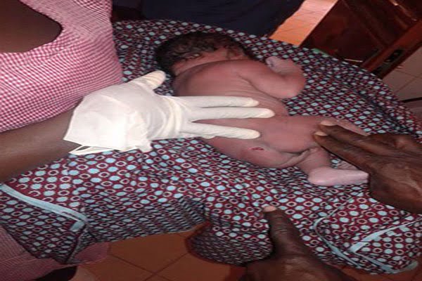 Burkina: Une femme enceinte reçoit une balle dans le ventre, le bébé sauvé de justesse (photos)