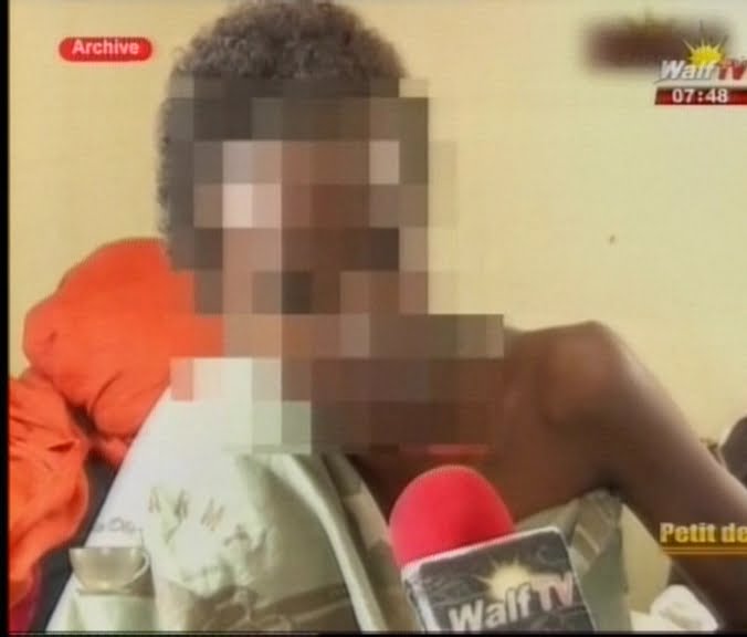 Vidéo: Cancer du sein  L’histoire bouleversante d’une jeune fille, Attention ! les images peuvent choquer