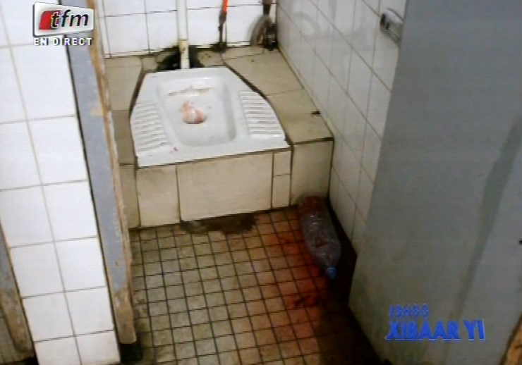 Vidéo: un bébé enfoncé dans les toilettes de l’hôpital de Saint-Louis. Regardez