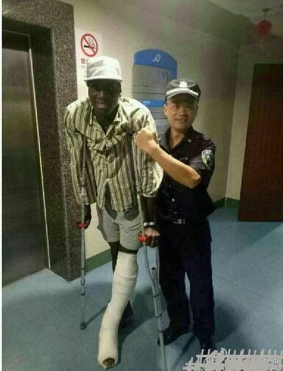 Photo – Demba Ba commence à marcher avec des béquilles