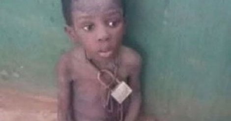 Photos – Cet enfant a été enchaîné et affamé pour avoir volé de la viande chez un pasteur