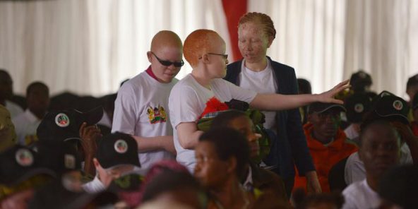 Kenya : les albinos ont leur concours de beauté pour lutter contre les préjugés