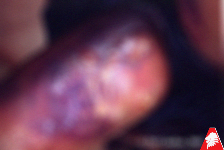 Audio – Des os et des insectes sortent de son corps!  Ecoutez !