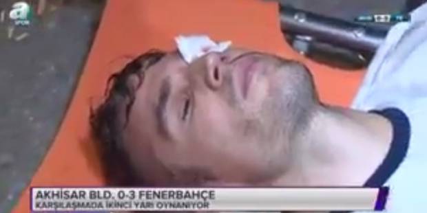 Vidéo : Van Persie, à deux doigts de perdre l’oeil gauche – Regardez.