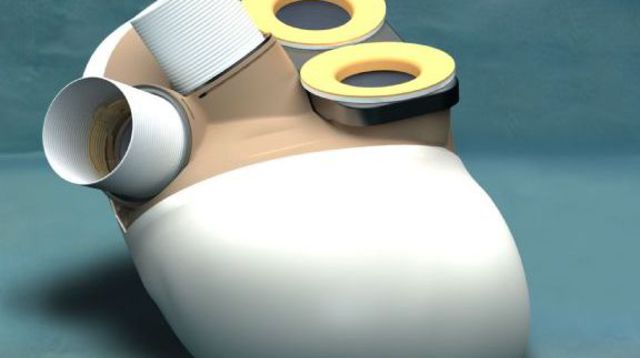 France : le 5e patient greffé du coeur artificiel de Carmat est décédé