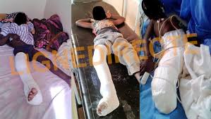 L’enfant Becaye finalement décede après l’amputation de sa jambe