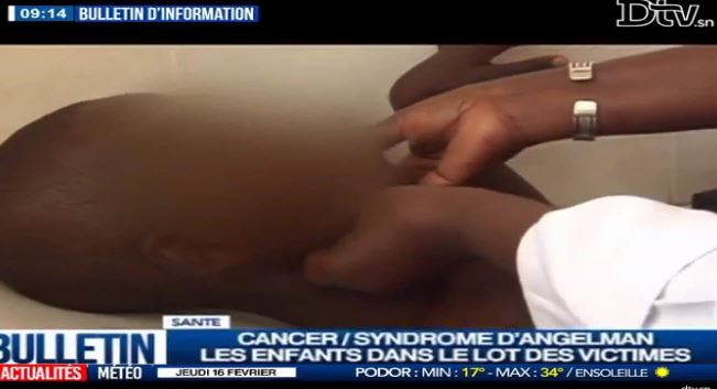 Vidéo-  Incroyable: Un enfant dakarois guéri du cancer des ganglions…