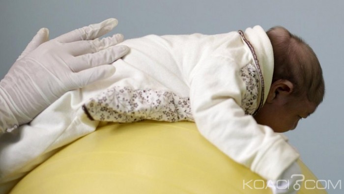 Angola : Virus Zika, une femme et son bébé contaminés
