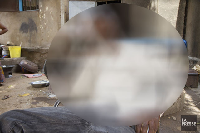 Audio – Xalass sur la Rfm : un homme amputé d’une jambe demande de l’aide…