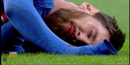 Vidéo – Real 1-1 Barça : Lionel Messi en sang après un coup de coude de Marcelo !