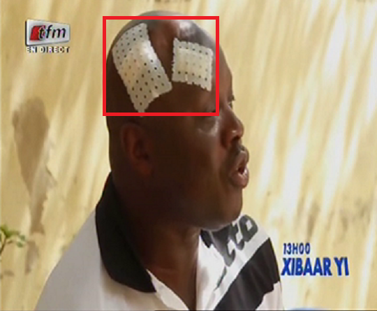 Vidéo : Amara Traoré explique son agression…Regardez