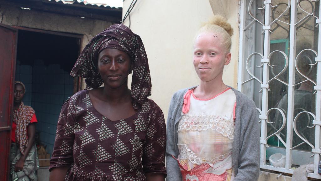 En Gambie, la sensibilisation à la cause des albinos porte ses fruits