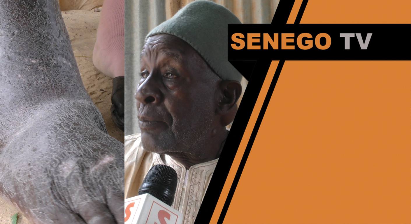 Senego TV : Malade depuis 2002, l’artiste Maodo Diagne étale sa souffrance et appelle à l’aide Marième Faye Sall