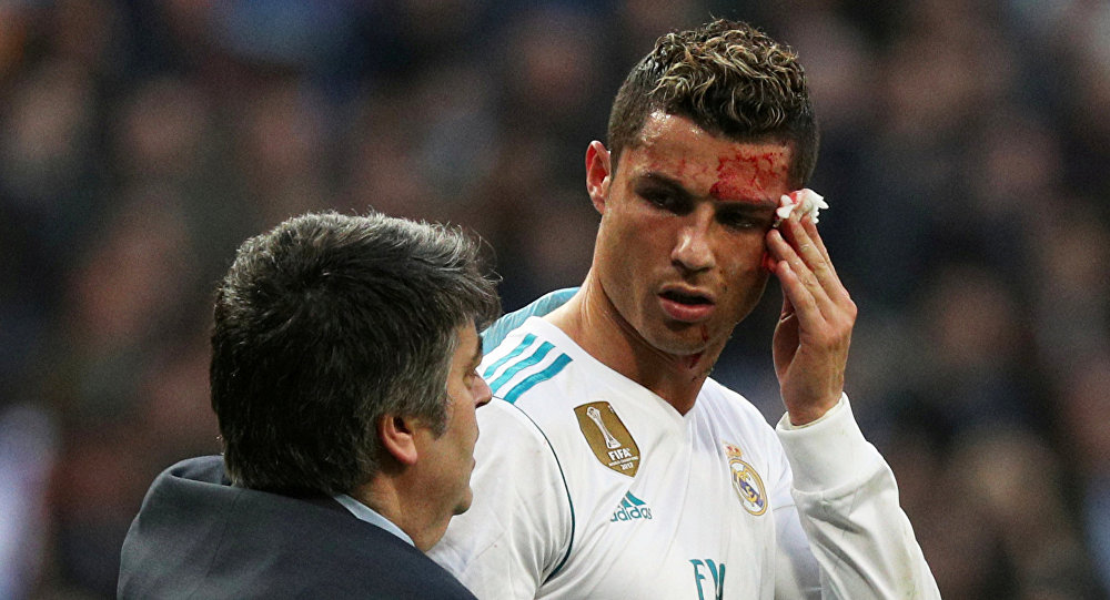 Vidéo: En sang face au Deportivo, Ronaldo va « bien »