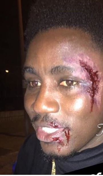 Arrêt sur image : Wally Seck défiguré par un kidnappeur.