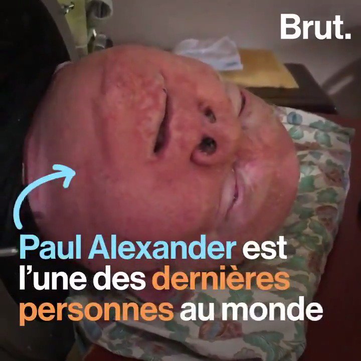 Vidéo – Il vit depuis plus de 65 ans dans un tube en acier. Voici l’histoire incroyable de Paul Alexander
