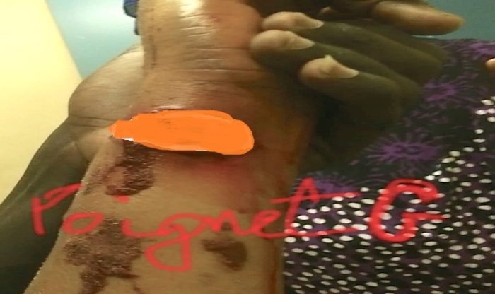La dame Salimata Diaw qui avait charcuté sa coépouse, « charcutée » à son son tour : elle écope de 5 ans de prison ferme