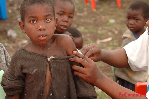 Urgent- Kédougou: une épidémie de rougeole sévit