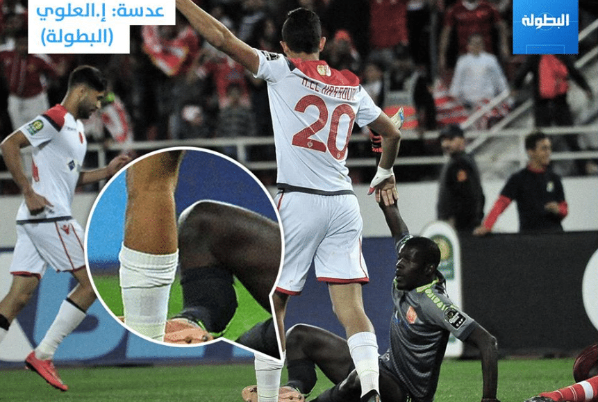 Arrêt sur image: l’horrible fracture de Khadim Ndiaye contre Wydad