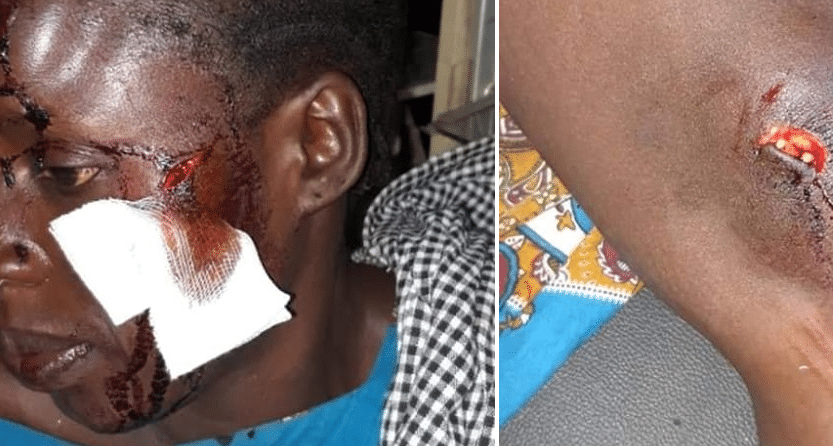 Nguéniène : La cheffe de Poste vétérinaire sauvagement agressée (photos)