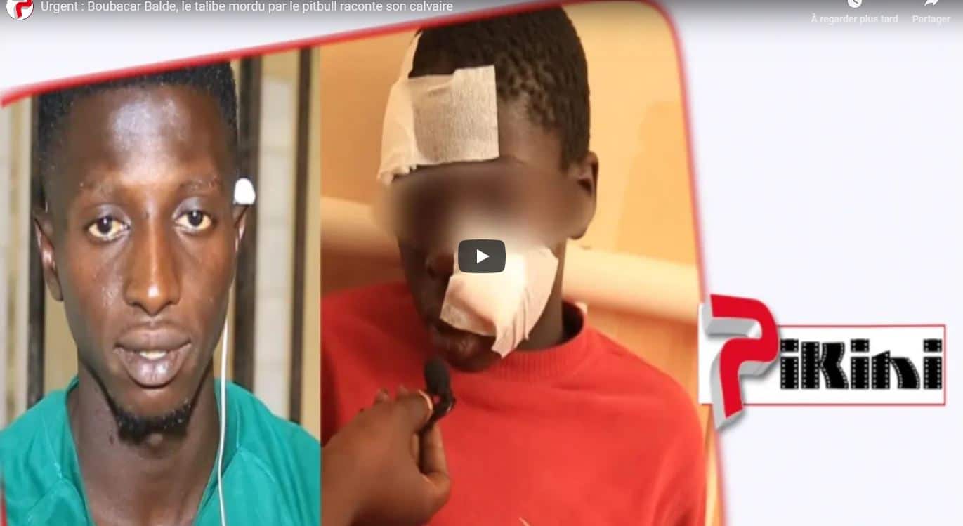 Pikine : Le talibé raconte l’attaque du pitbull (vidéo)