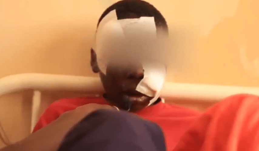 Boubacar Baldé, le talibé mordu par le pitbull raconte les faits : « Défouma dara mou mateu ma » (Vidéo)