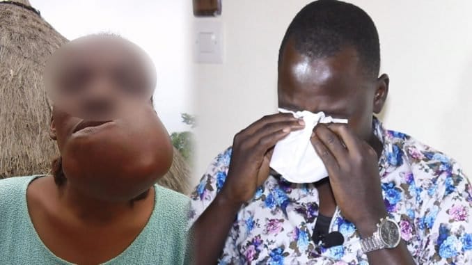 Cancer de l’œsophage :  Cette dame souffre terriblement…(vidéo)
