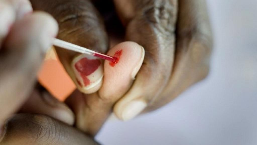 Sida : La nouvelle stratégie mondiale contre le Sida vise à « mettre fin aux inégalités »
