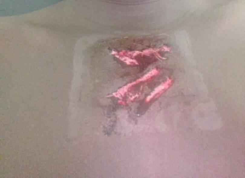 Ucad : Un étudiant grièvement blessé par une grenade lacrymogène