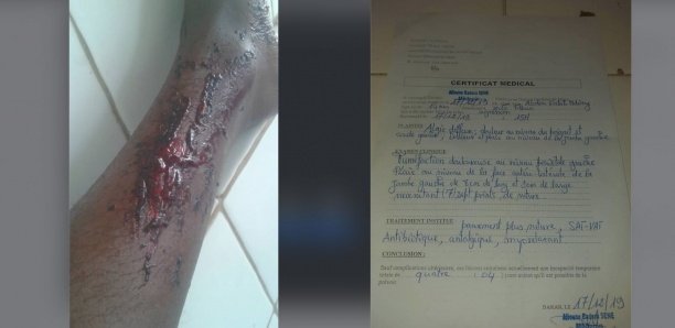Violences conjugales : Il mord son fils et répudie sa « awo »…