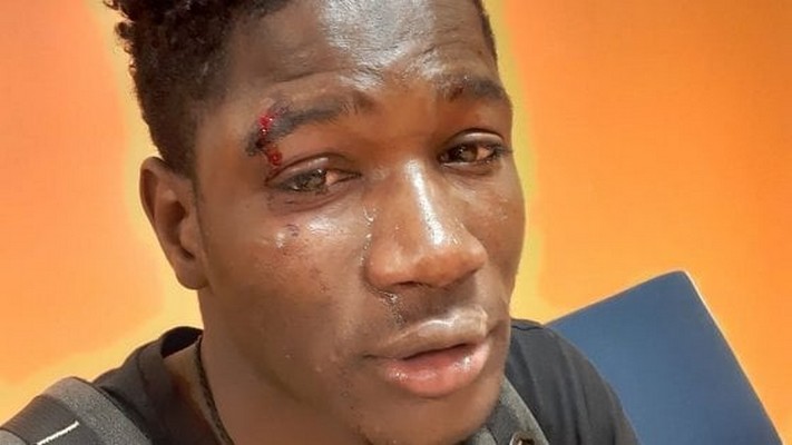 Italie : Agression raciste à Palerme, un Sénégalais battu et blessé