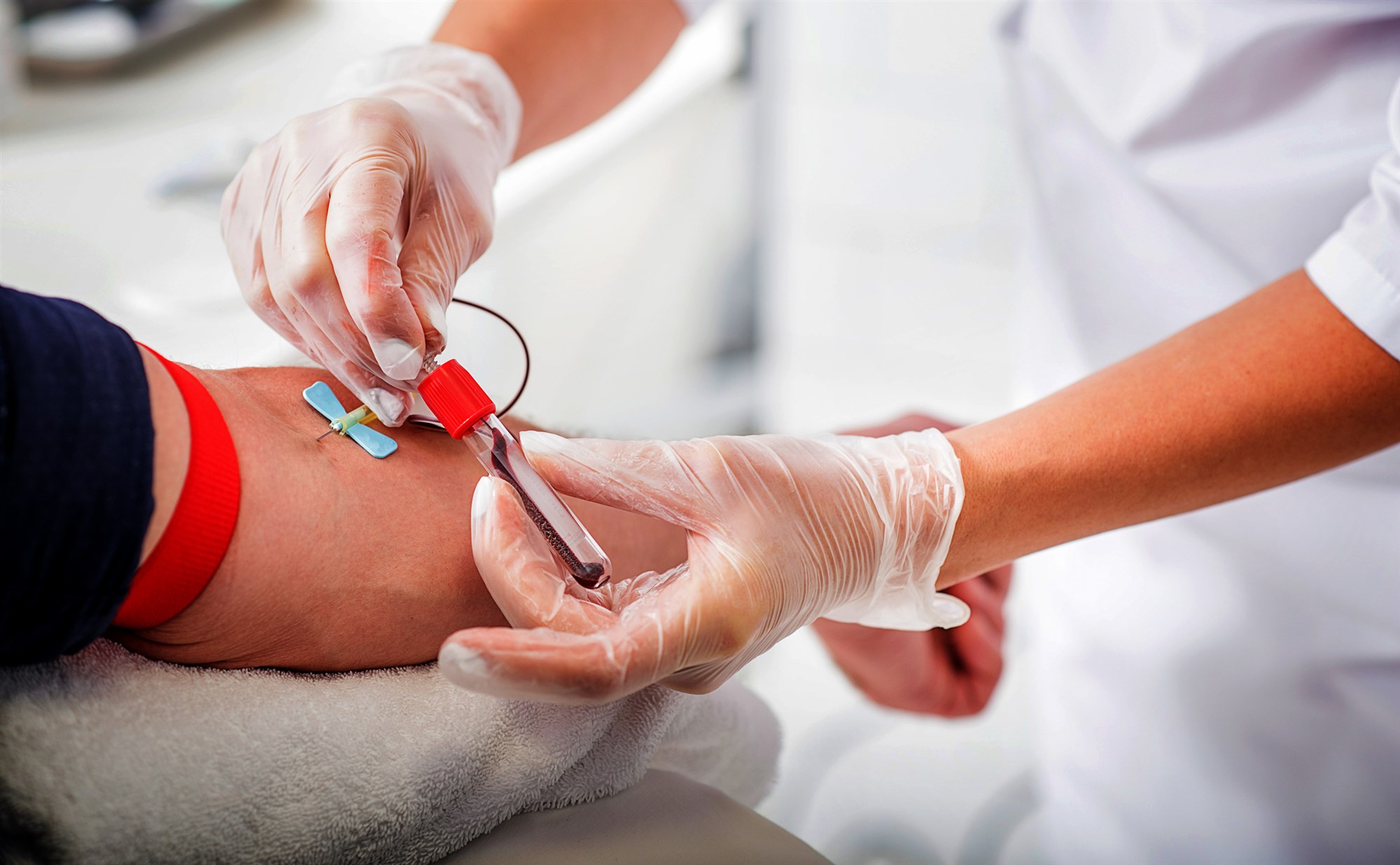 Collecte de sang : Les médecins ne peuvent utiliser les anticorps Covid-19 de gays