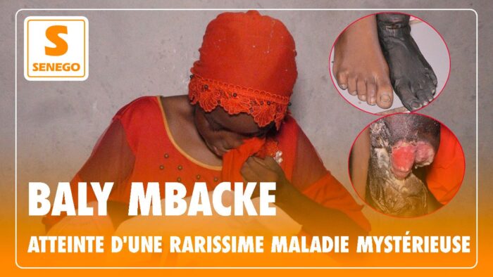 Atteinte d’une maladie mystérieuse rarissime, la jeune Baly Mbacké sollicite de l’aide (Senego-TV)