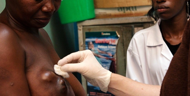 Situation alarmante du cancer au Sénégal : 1841 cas diagnostiqués en 2019-Dr Babacar Guèye