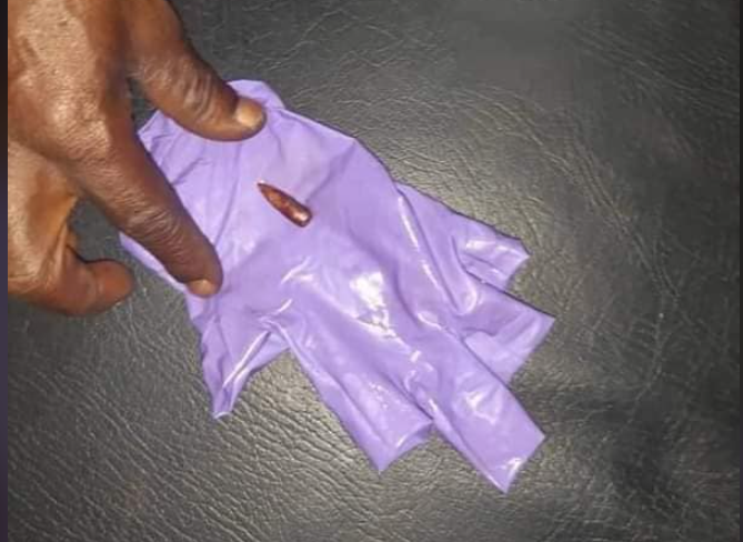 Crise postélectorale en Guinée: un bébé de 14 mois touché par balle, un autre de 3 ans tué (Photos)