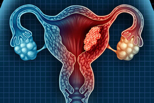 2400 nouveaux cas de cancers gynécologiques chaque année au Sénégal : Barthimée fait le diagnostic