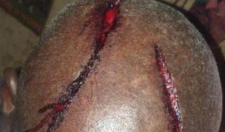 Kelle : les deux enseignements blessés par des agresseurs…(photo)