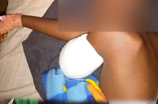 Soutien à Sonko : L’élève amputé du bras sorti d’hôpital
