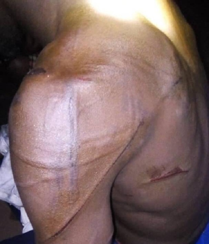 Tivaouane Peulh  : Un gendarme tire sur un voleur qui lui donne un coup de machette à la tempe