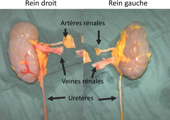Implantation rénale : Le Sénégal commence très bientôt les opérations