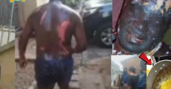 Ziguinchor : Un maton ébouillanté par la mère de son enfant…