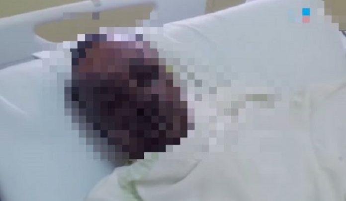 Une femme jette de l’eau bouillante sur son mari de 31 ans
