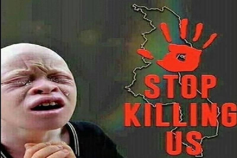 « Crime rituel » d’un enfant albinos au Mali : La rage de Salif Keïta…