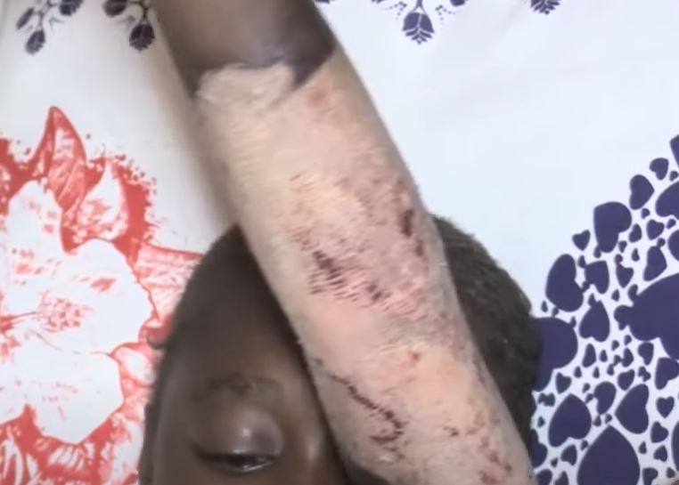 Thiès : Un câble électrique à haute tension électrocute une fille de 12 ans…vidéo